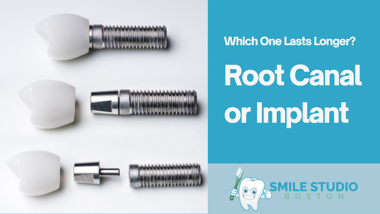 Root Canal or Implant – Which One Lasts Longer?